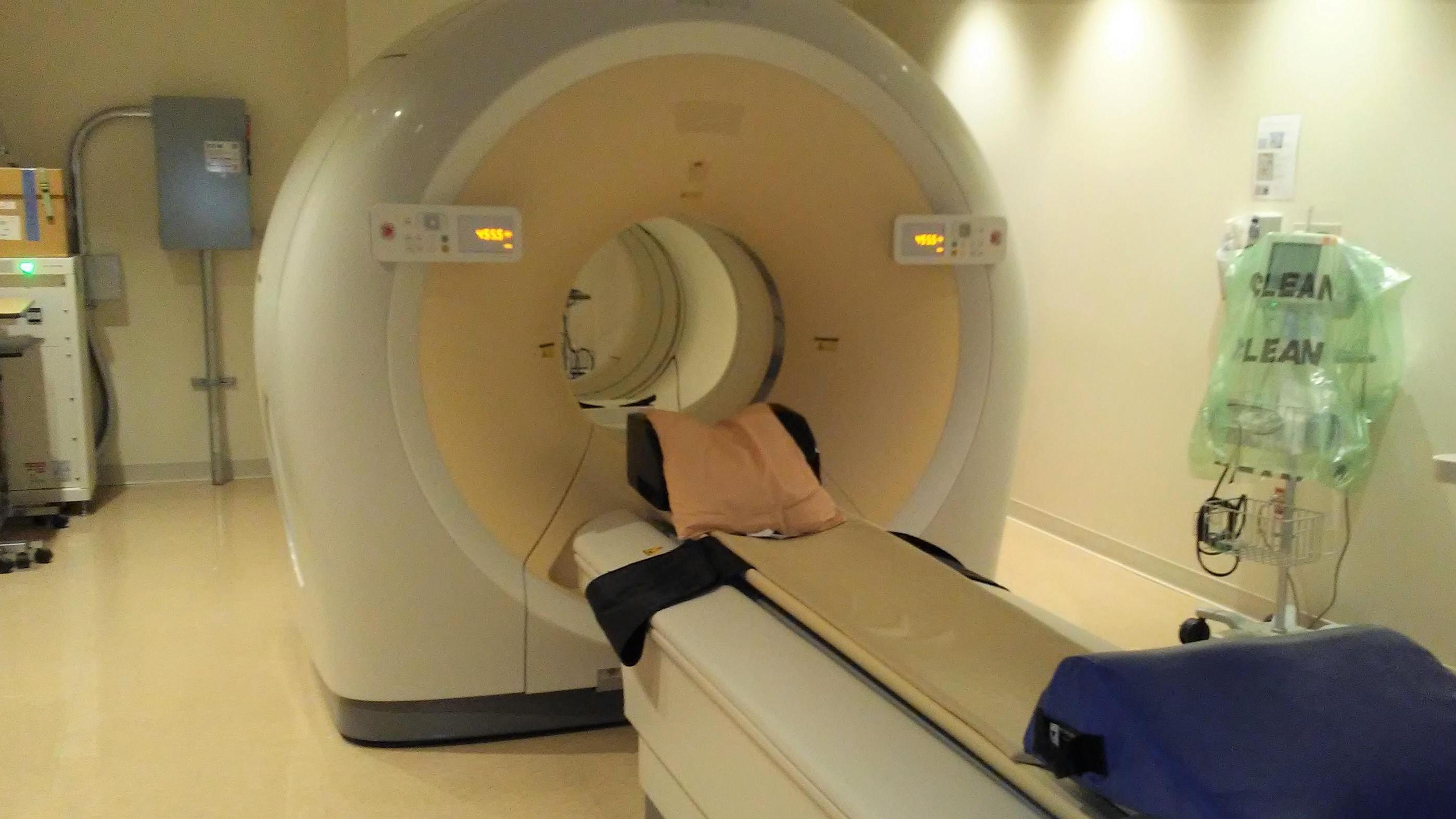 IMAGING OF IN VIVO SIGMA-2 RECEPTOR EXPRESSION WITH [18F]ISO-1 POSITRON EMISSION TOMOGRAPHY (PET/CT) IN METASTATIC BREAST CANCER