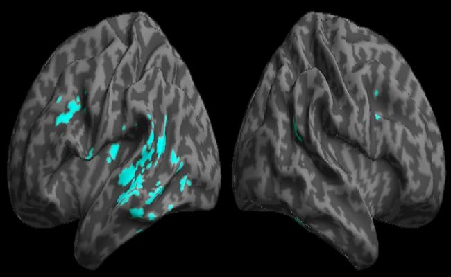 Conceptual Processing in Alzheimer’s Disease